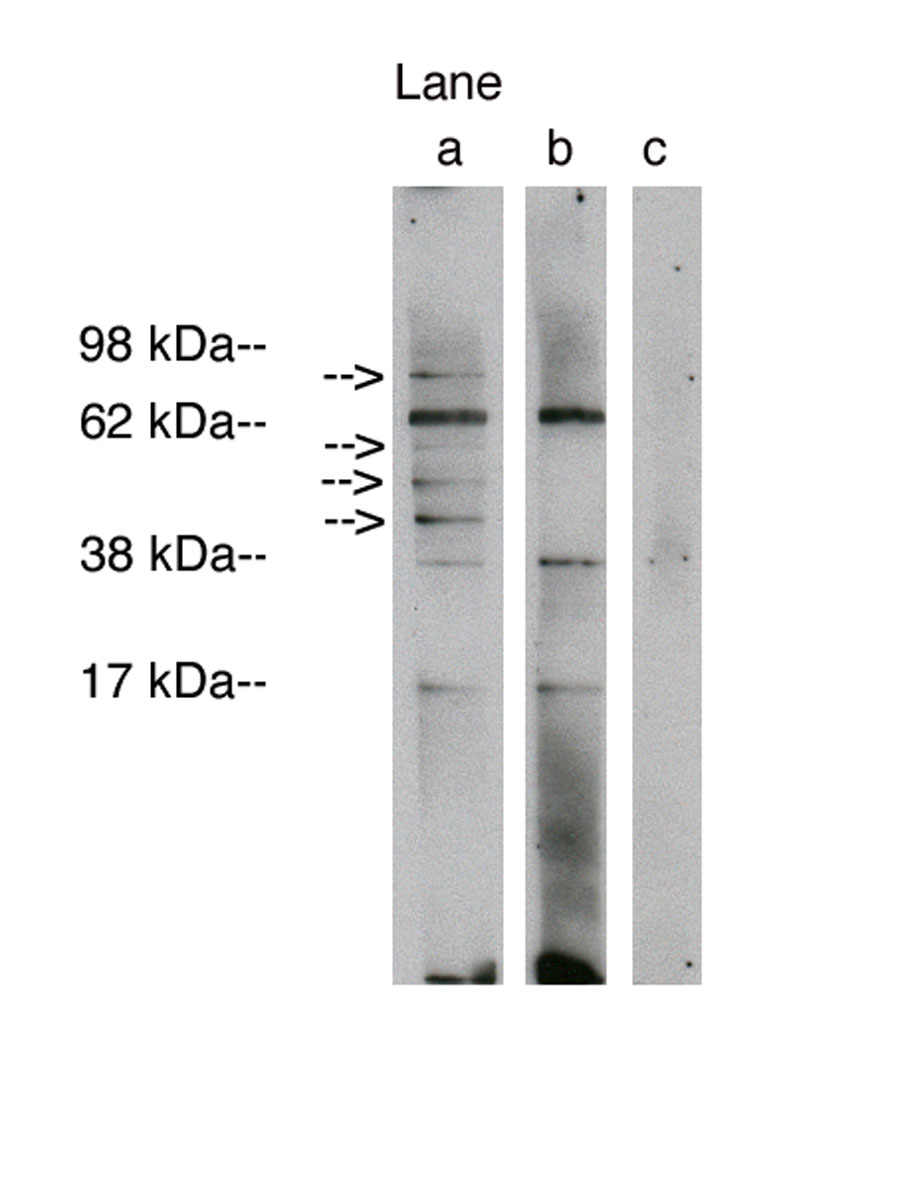 Western blot analysis using LAG1 longevity assurance homolog 1 (Cat. # X2310P) at 5 ug/ml on human brain lysate 14 ug/lane (Cat. # X1633C).  Lane A] antibody alone, Lane B] antibody with 45ug blocking peptide, Lane C] conjugate alone. Visualized using Pierce West Femto substrate system.  Anti Rabbit secondary used at 1:3.5K dilution (Cat. # X1207M). Exposure for 5 min